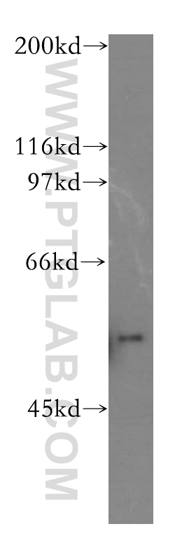 WB analysis of mouse brain using 13257-2-AP