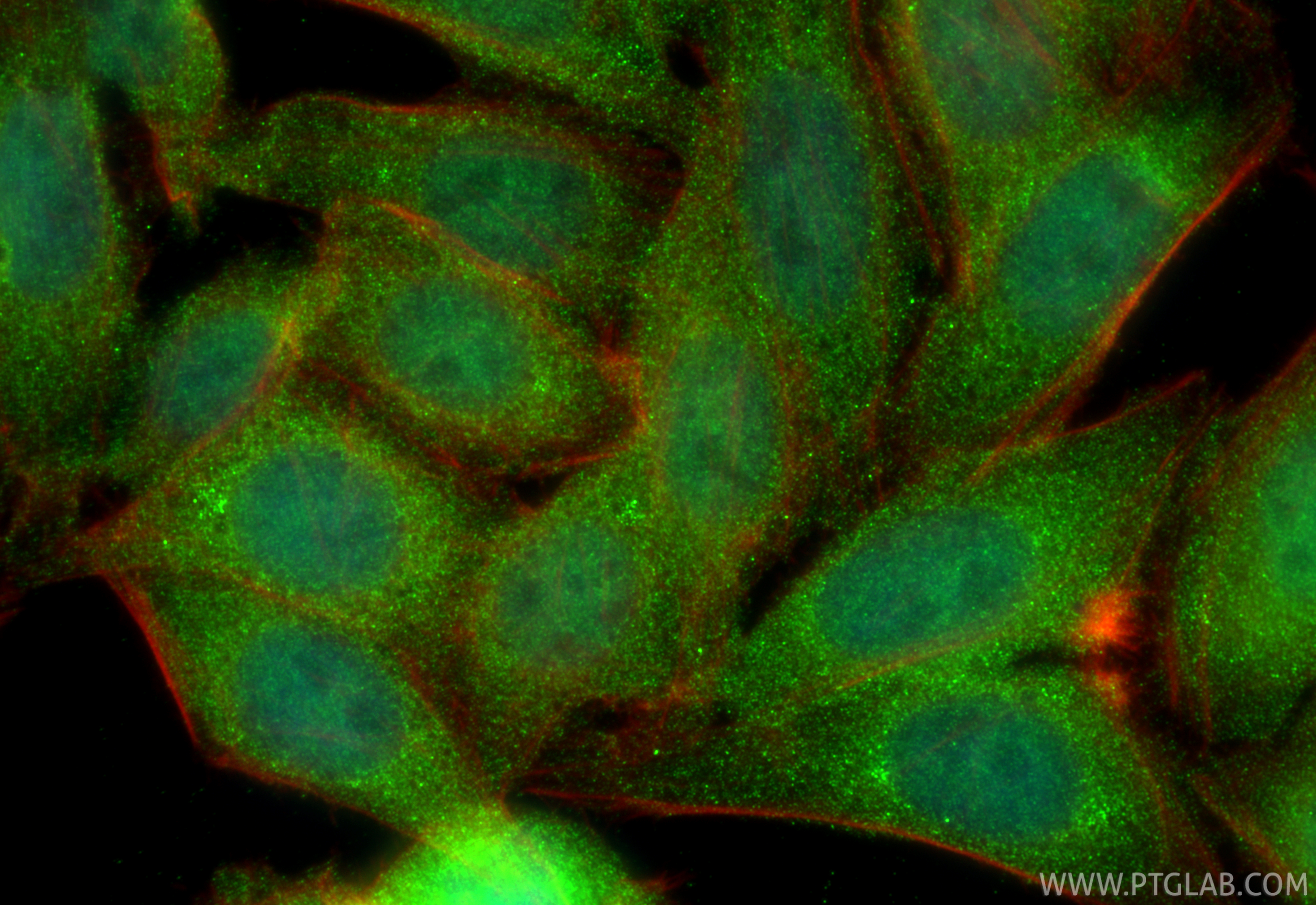 IF Staining of HepG2 using 13973-1-AP IF Staining of HepG2 using 13973-1-AP