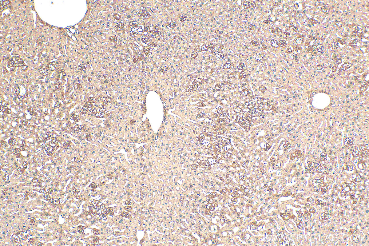IHC staining of mouse liver using 13973-1-AP