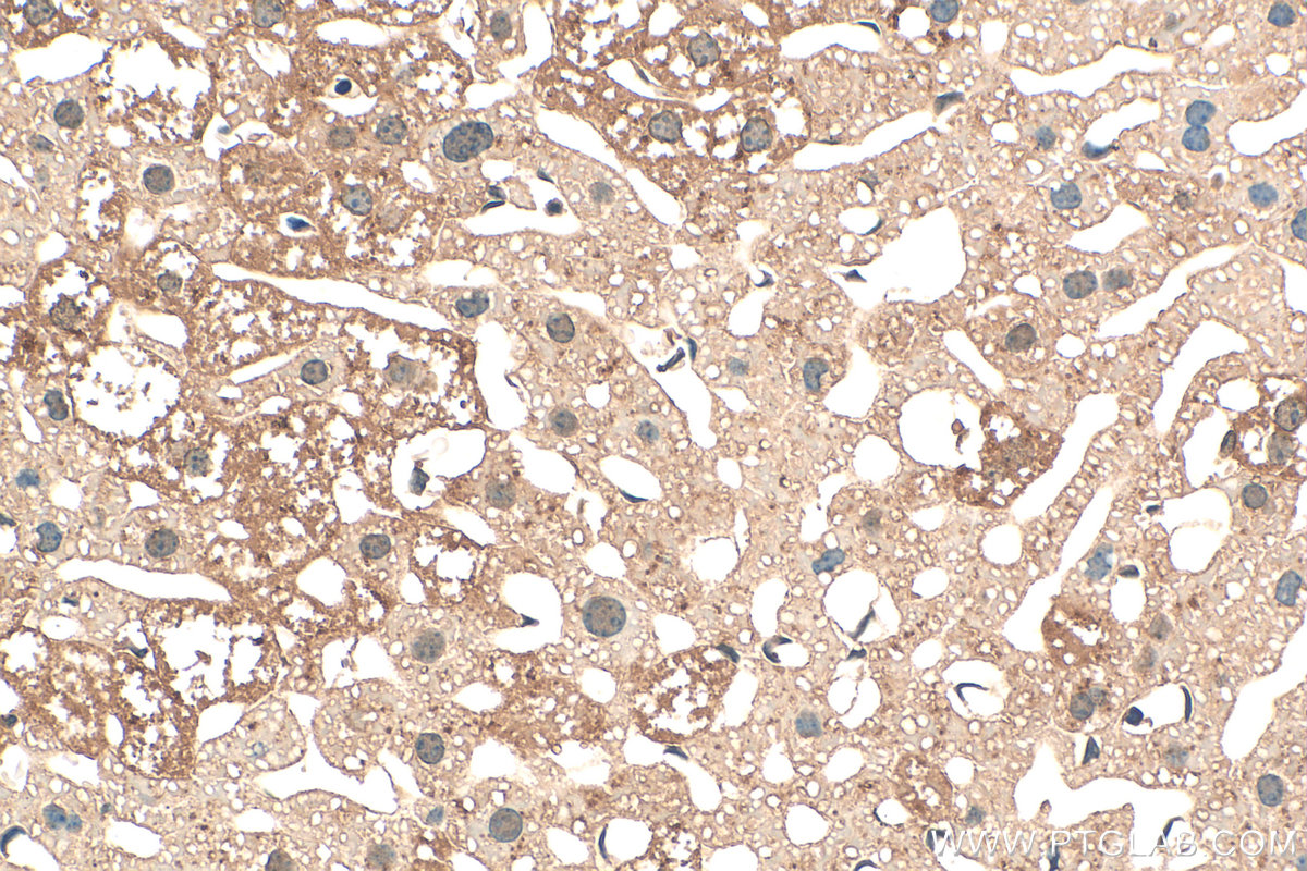 IHC staining of mouse liver using 13973-1-AP