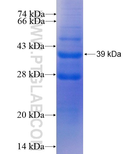 ATE1 fusion protein Ag5156 SDS-PAGE ATE1 fusion protein Ag5156 SDS-PAGE