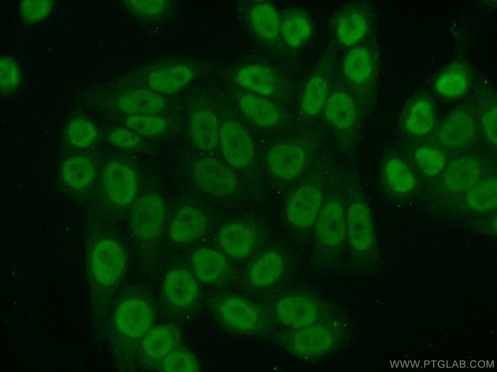 IF Staining of HeLa using 11946-1-AP