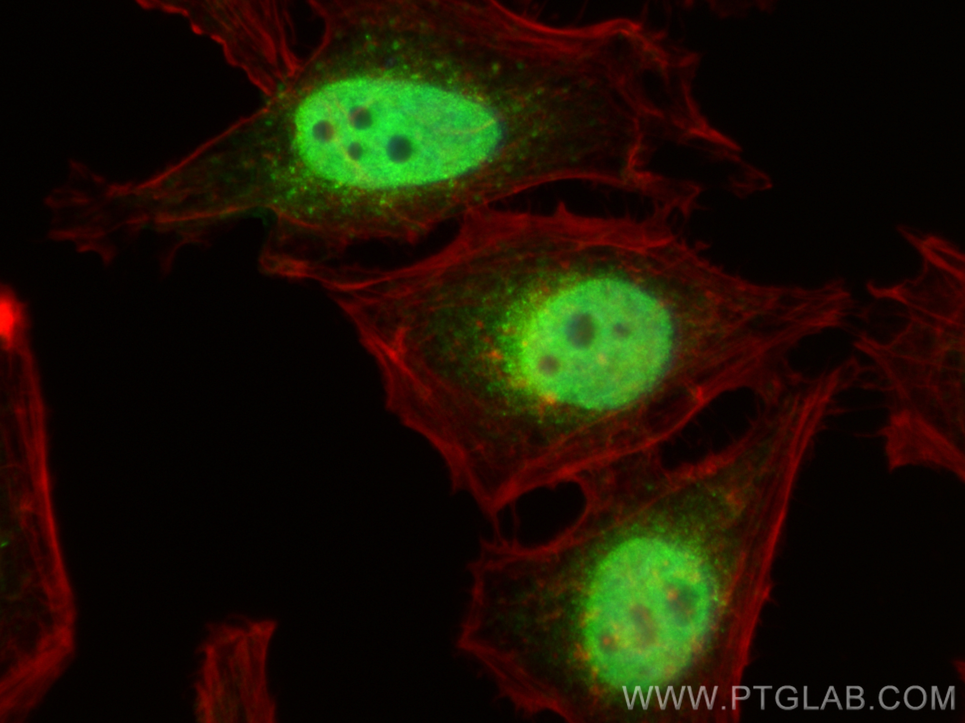 IF Staining of HeLa using 11946-1-AP