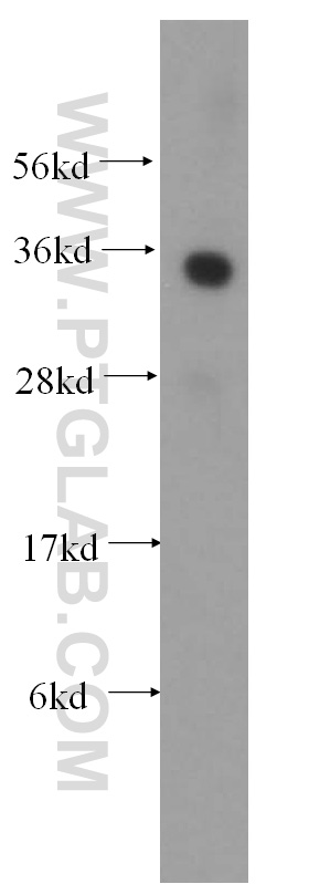 WB analysis of HeLa using 11946-1-AP