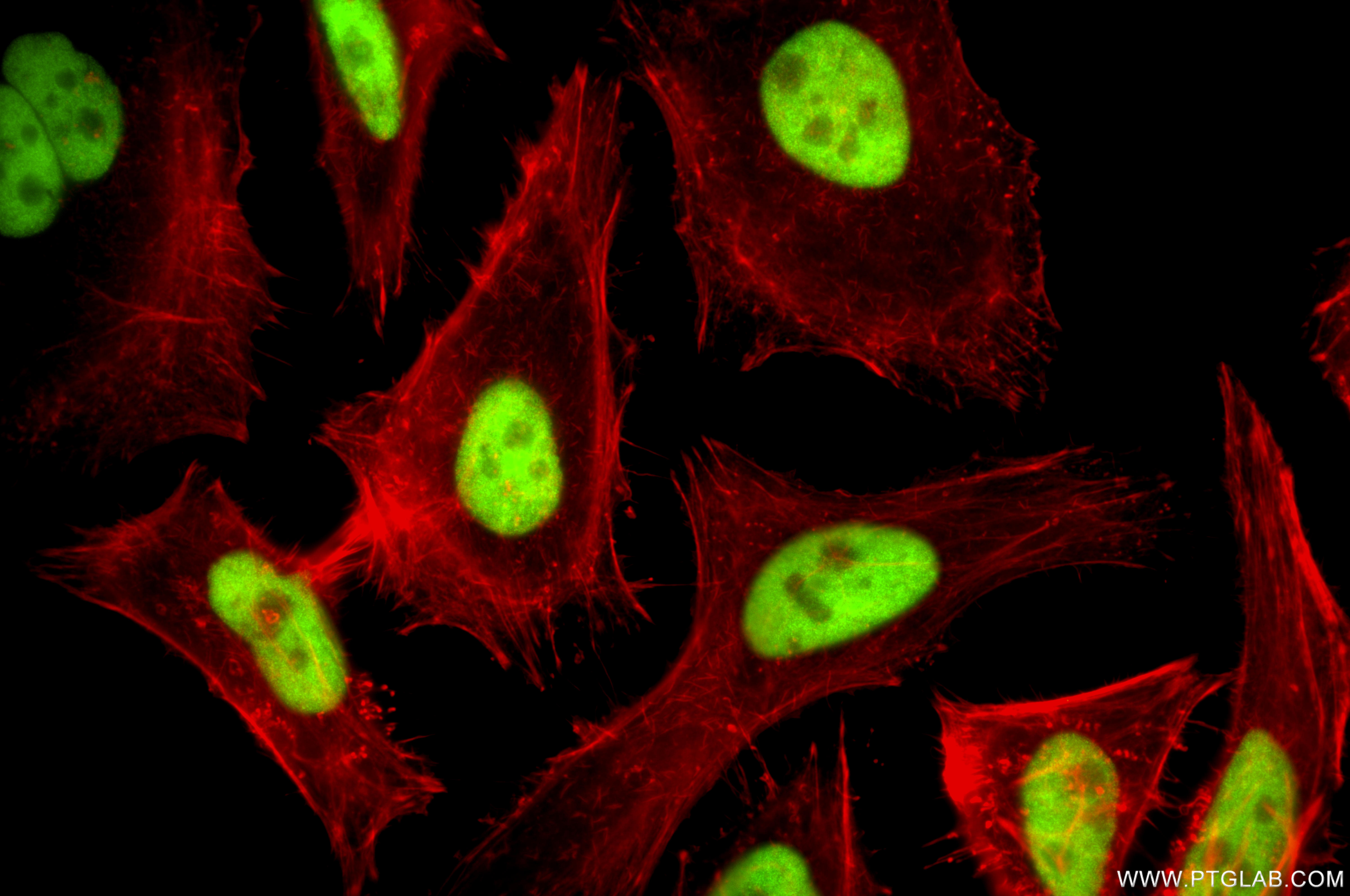 IF Staining of HeLa using 87421-1-RR (same clone as 87421-1-PBS) IF Staining of HeLa using 87421-1-RR (same clone as 87421-1-PBS)