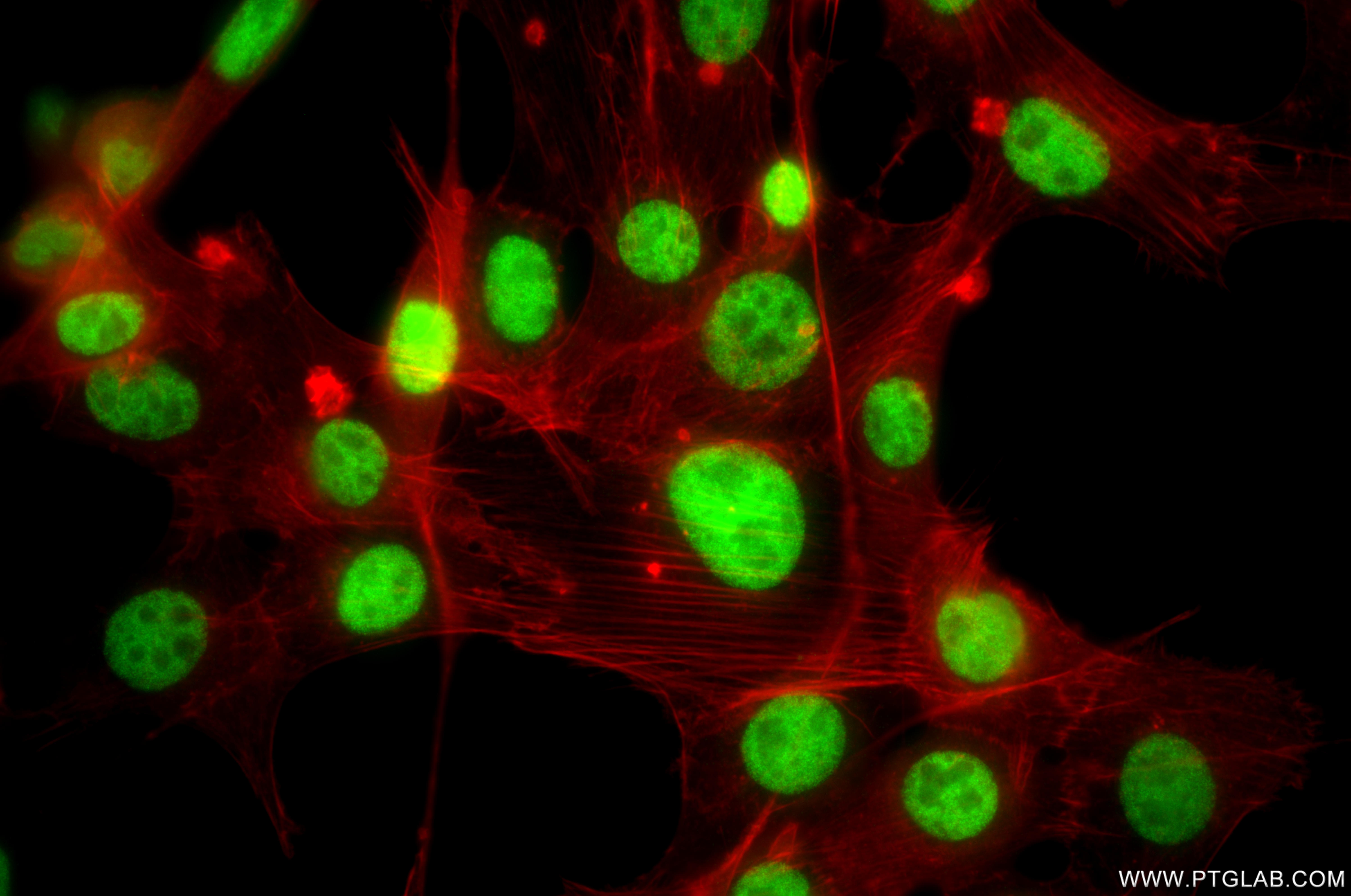 IF Staining of NIH/3T3 using 87421-1-RR (same clone as 87421-1-PBS) IF Staining of NIH/3T3 using 87421-1-RR (same clone as 87421-1-PBS)