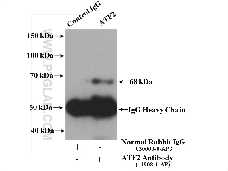 IP experiment of mouse brain using 11908-1-AP