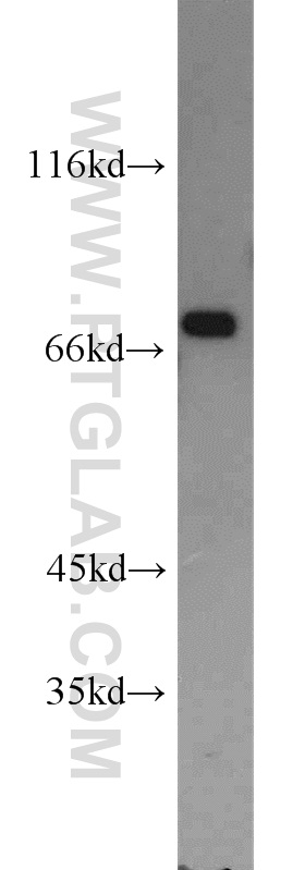 ATF2-Specific Polyclonal antibody