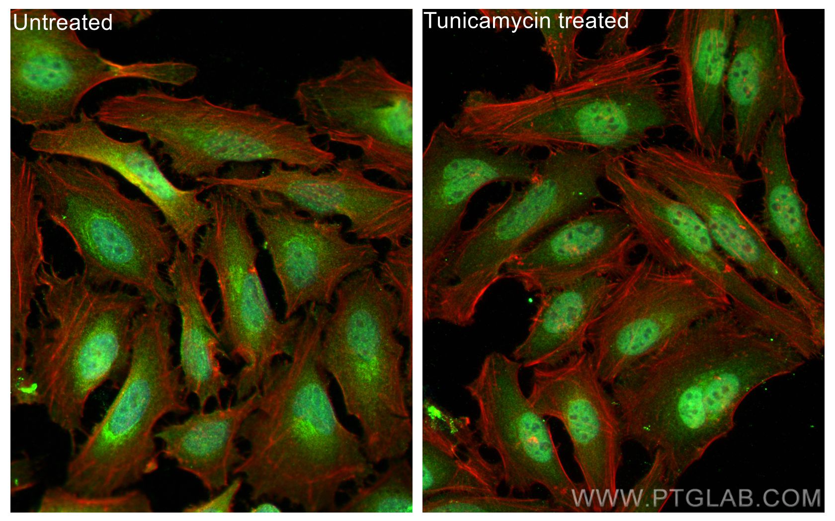 IF Staining of HeLa using 10835-1-AP