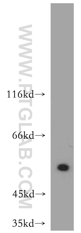 ATF4 Polyclonal antibody