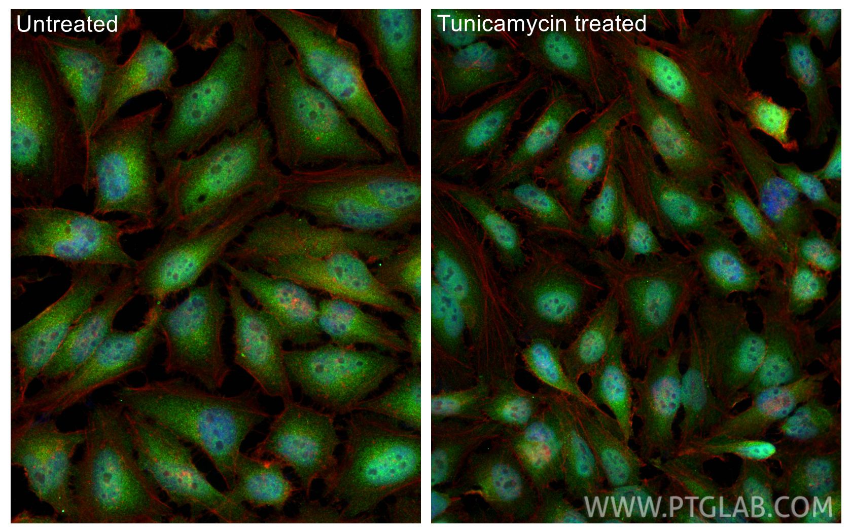 IF Staining of HeLa using 28657-1-AP