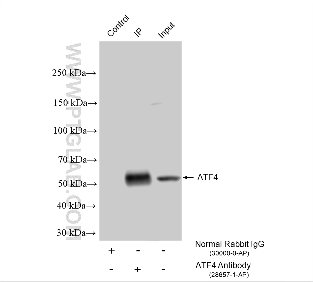 IP result of anti-ATF4 (IP:28657-1-AP, 4ug; Detection:28657-1-AP 1:2000) with A431 cells lysate 1040 ug. IP experiment of A431 using 28657-1-AP
