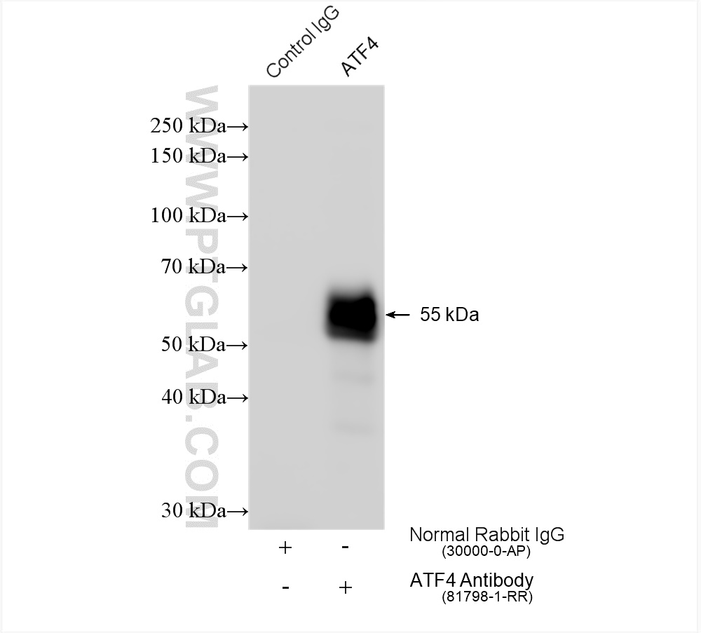 IP experiment of HEK-293 using 81798-1-RR