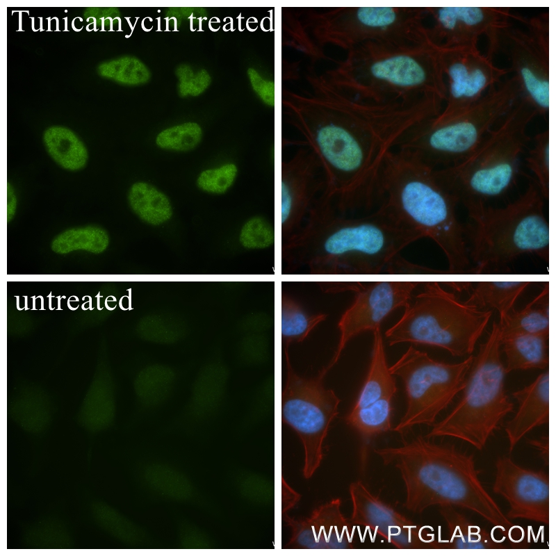 IF Staining of HeLa using 81798-2-RR (same clone as 81798-2-PBS)