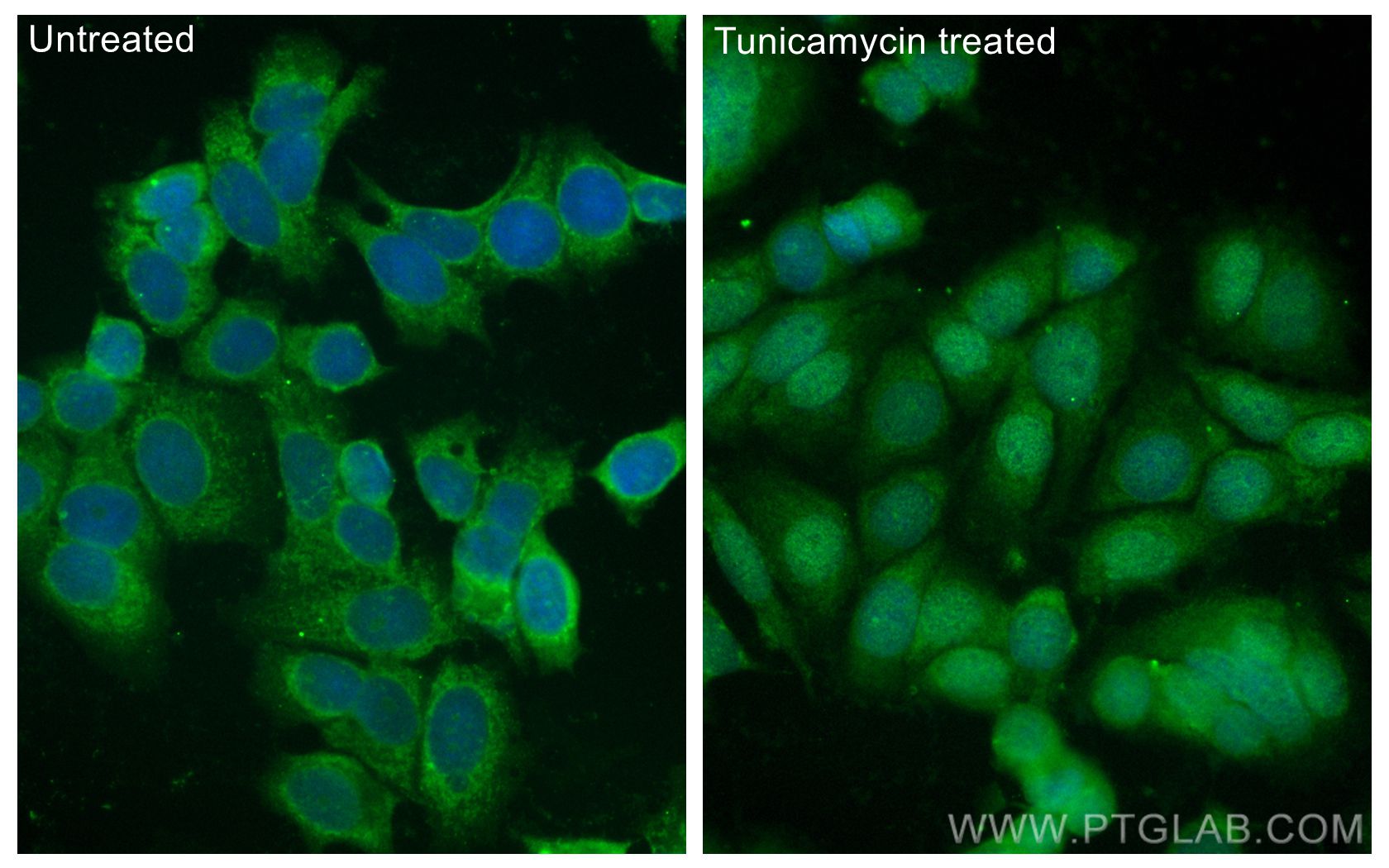 IF Staining of MCF-7 using CL488-10835