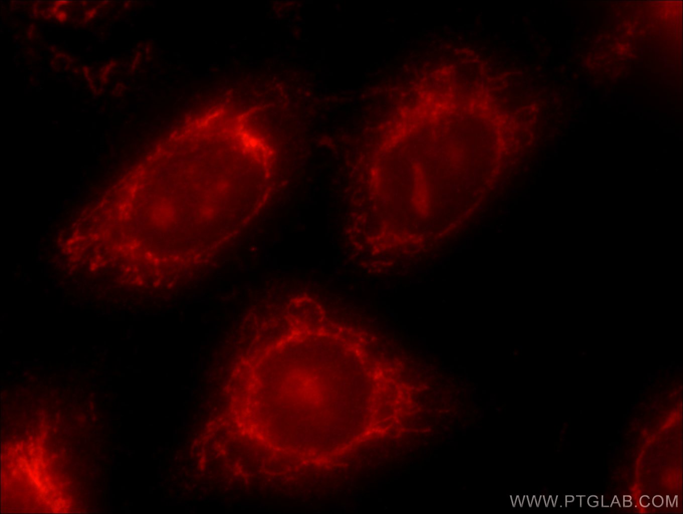 IF Staining of HeLa using 24169-1-AP