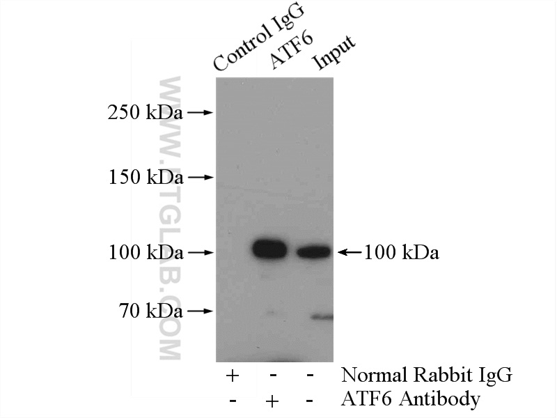 IP experiment of HeLa using 24169-1-AP