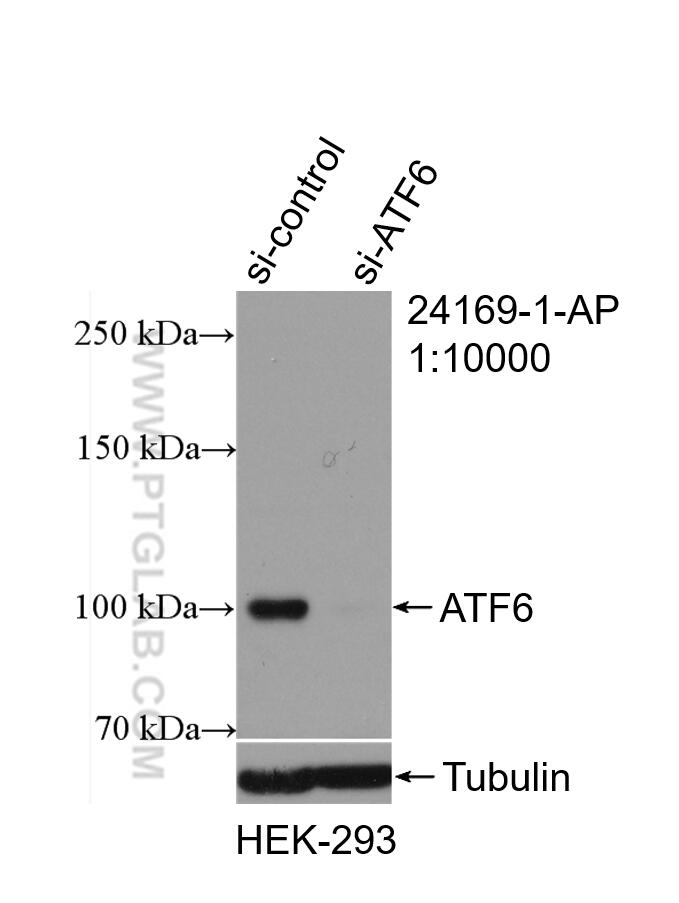 WB analysis of HEK-293 using 24169-1-AP