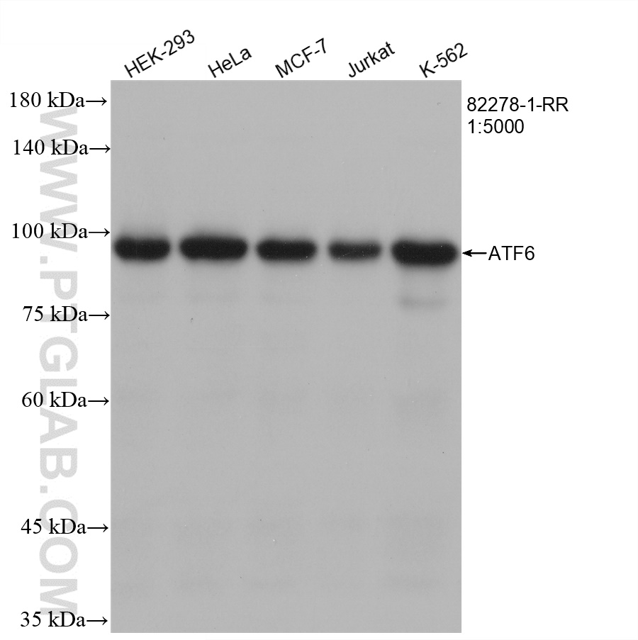 WB analysis using 82278-1-RR