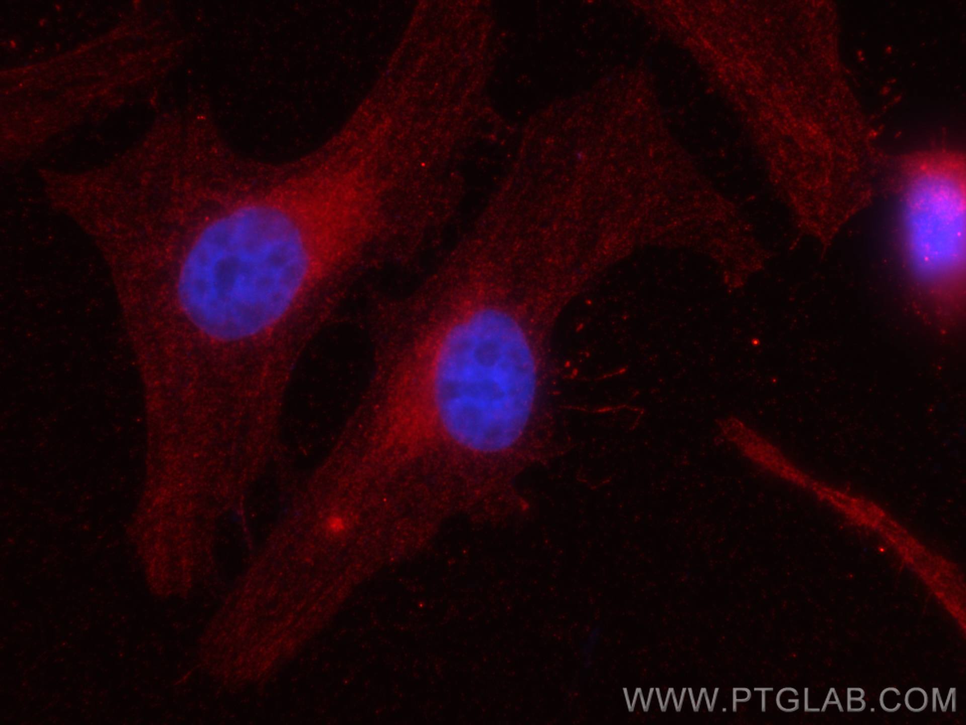 IF Staining of HeLa using CL594-66563