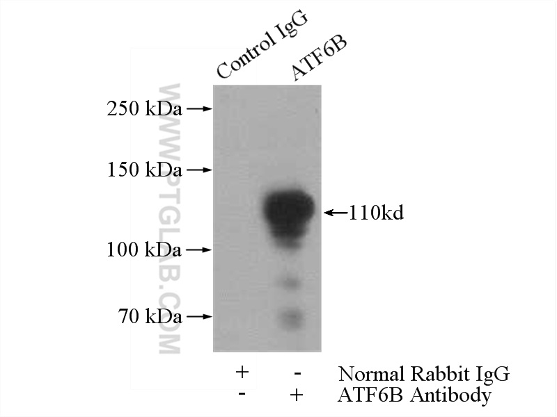 IP experiment of Jurkat using 15794-1-AP