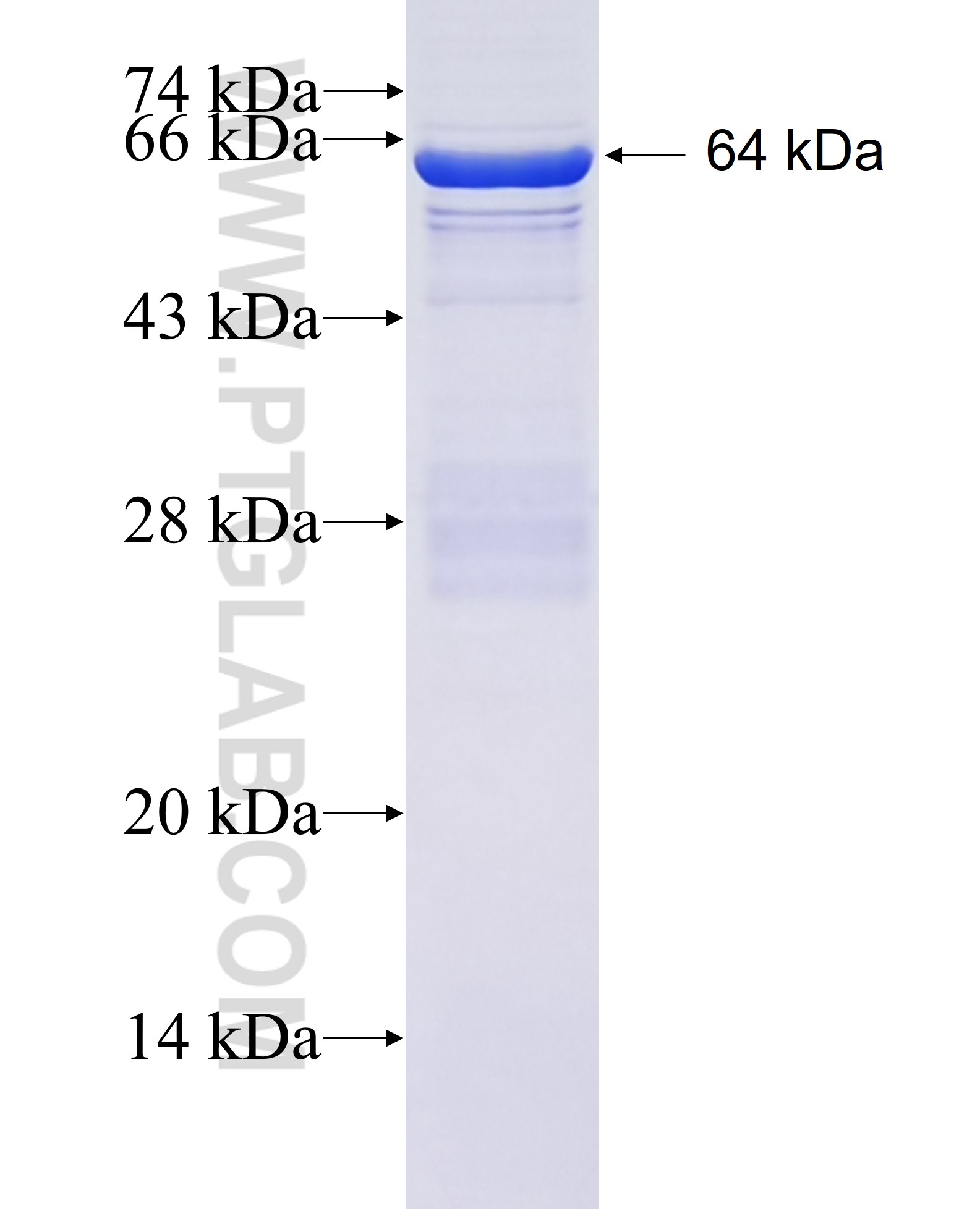 ATF7IP fusion protein Ag6341 SDS-PAGE