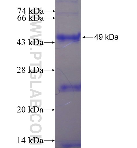 ATF7IP2 fusion protein Ag11979 SDS-PAGE ATF7IP2 fusion protein Ag11979 SDS-PAGE