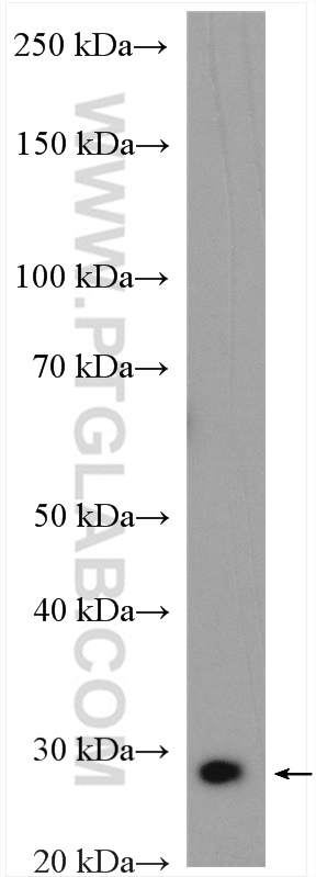 WB analysis of mouse brain using 26562-1-AP