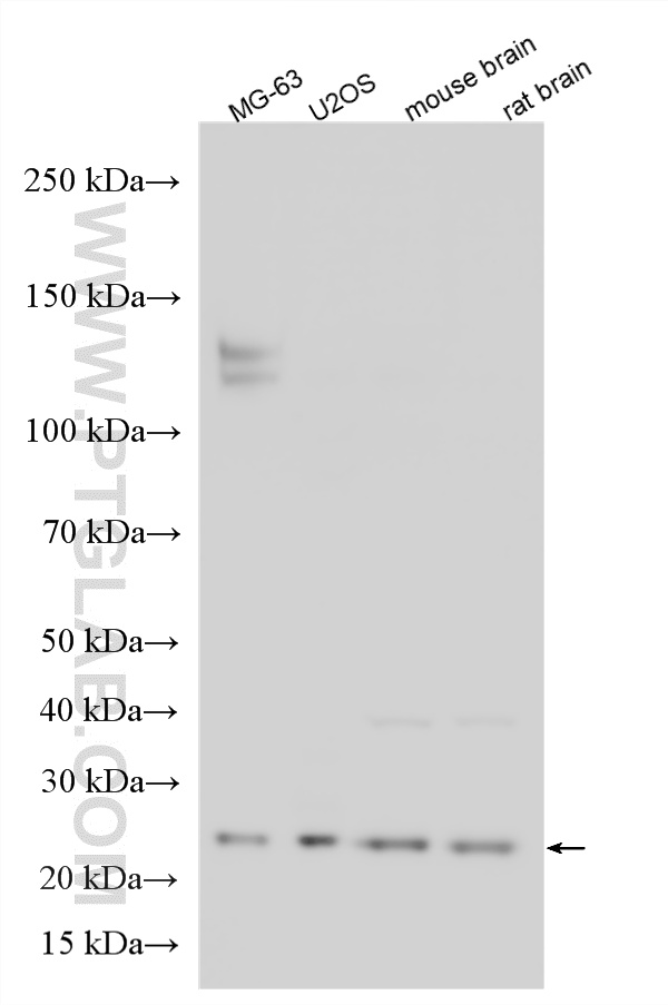 WB analysis using 26562-1-AP WB analysis using 26562-1-AP