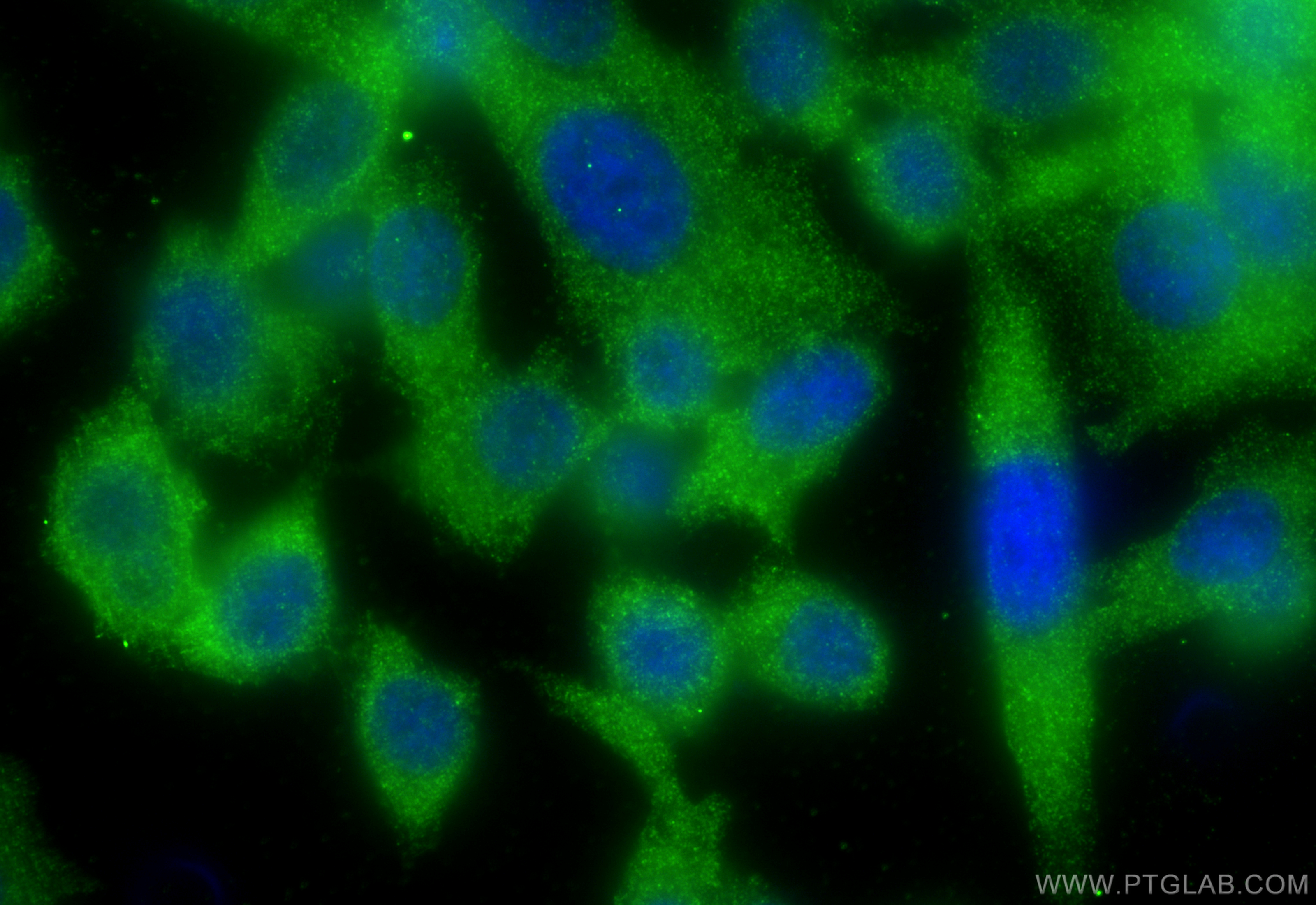 IF Staining of PC-3 using 11264-1-AP
