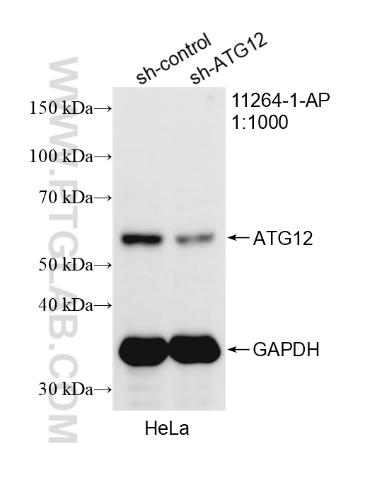 WB analysis of HeLa using 11264-1-AP WB analysis of HeLa using 11264-1-AP