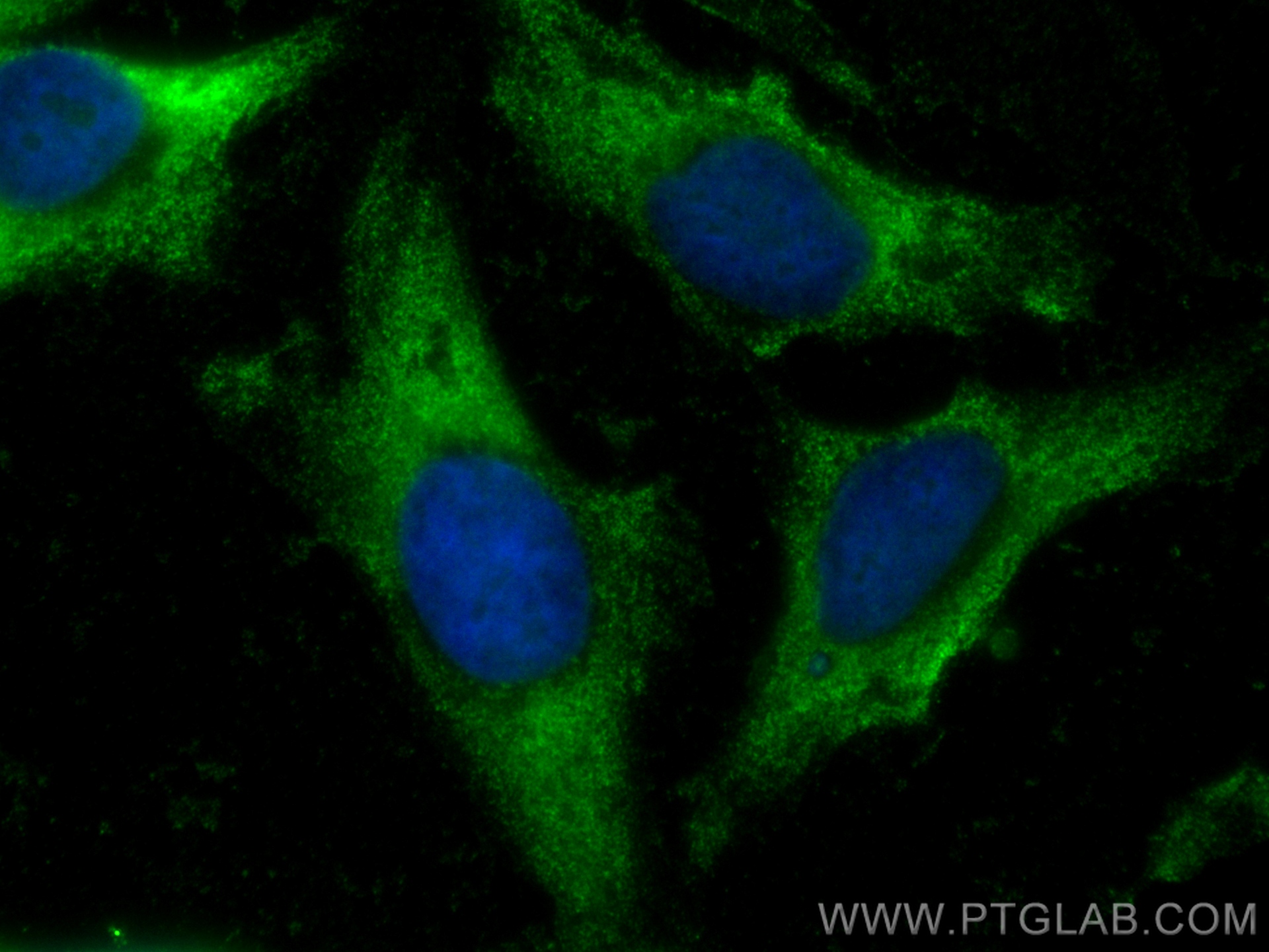 IF Staining of HeLa using CL488-66708