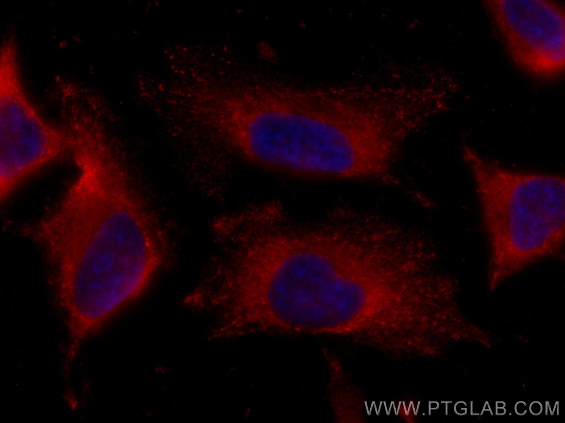 IF Staining of HeLa using CL594-66708