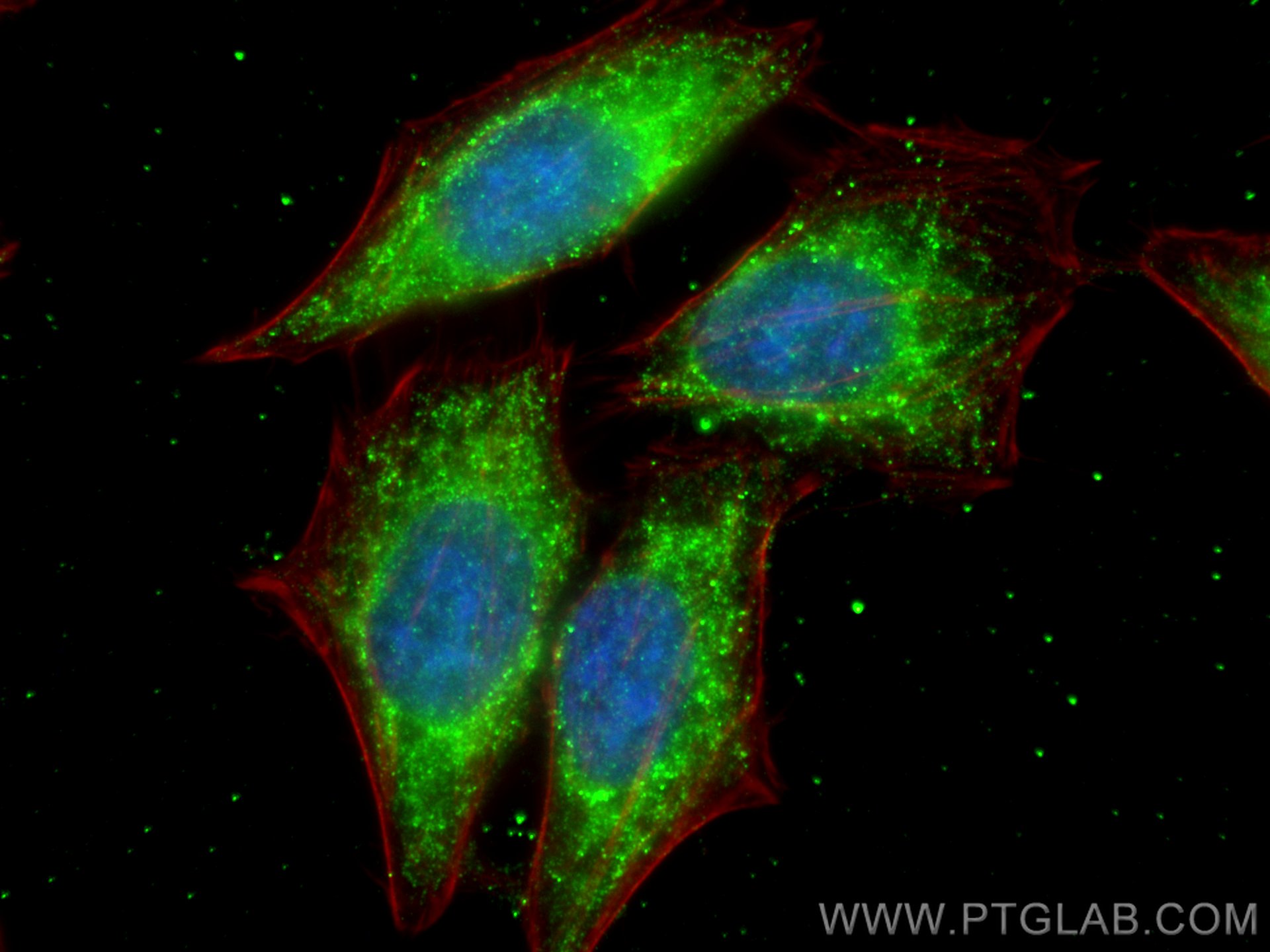 IF Staining of HepG2 using 67943-1-Ig (same clone as 67943-1-PBS)