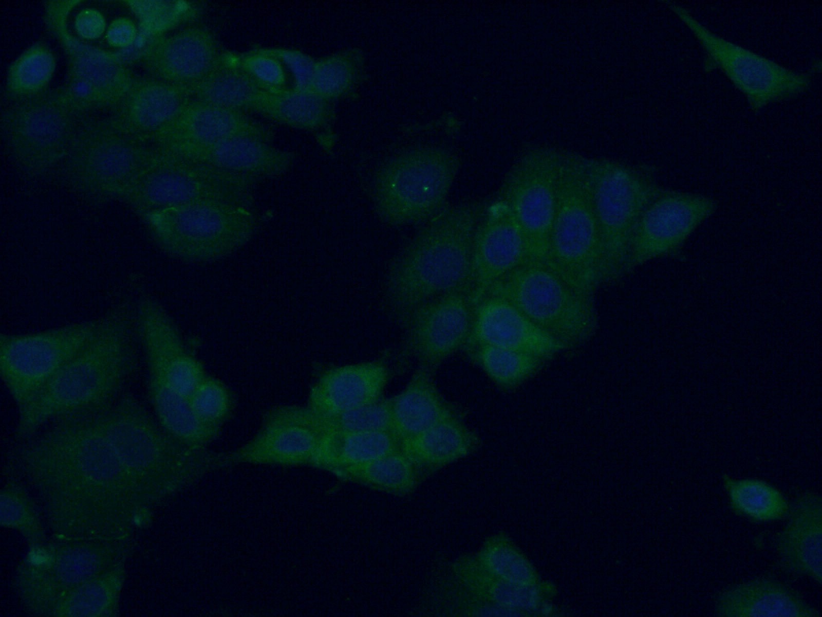 IF Staining of MCF-7 using 24322-1-AP