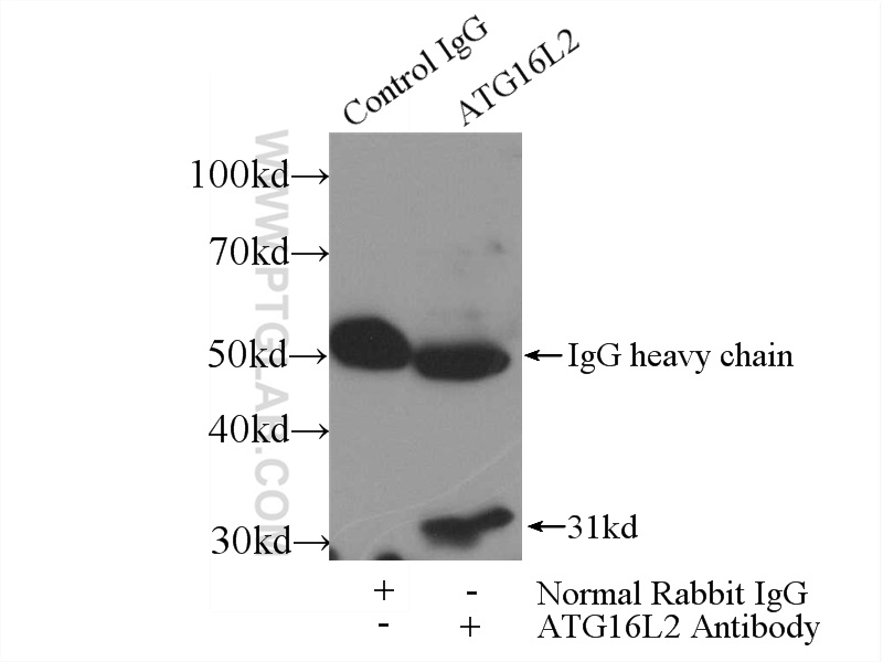 IP experiment of mouse testis using 24322-1-AP