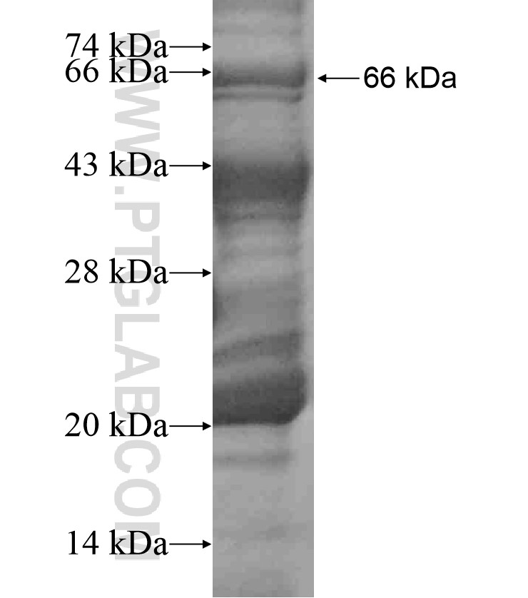ATG16L2 fusion protein Ag18447 SDS-PAGE ATG16L2 fusion protein Ag18447 SDS-PAGE
