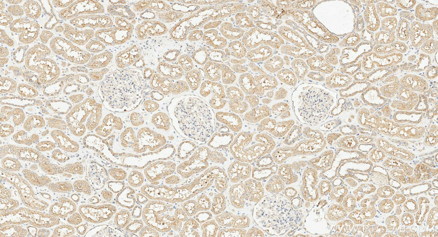 IHC staining of human kidney using 23226-1-AP IHC staining of human kidney using 23226-1-AP