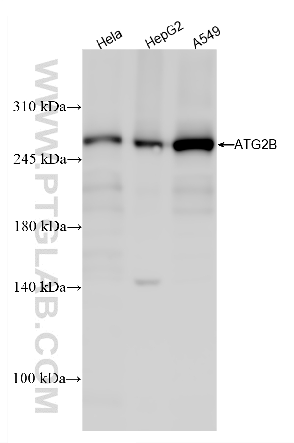 WB analysis using 25155-1-AP