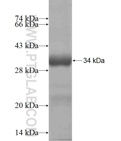 ATG2B fusion protein Ag18552 SDS-PAGE