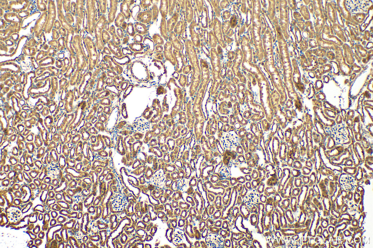 IHC staining of mouse kidney using 11262-2-AP