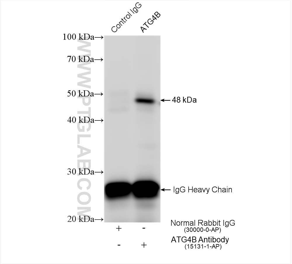 IP experiment of HeLa using 15131-1-AP