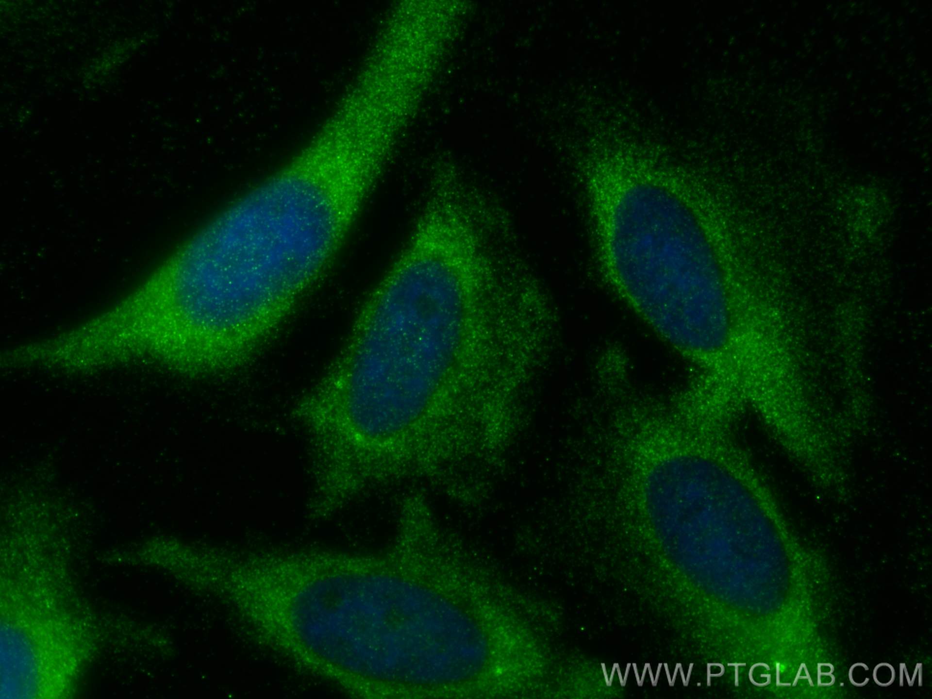 IF Staining of HeLa using 20382-1-AP