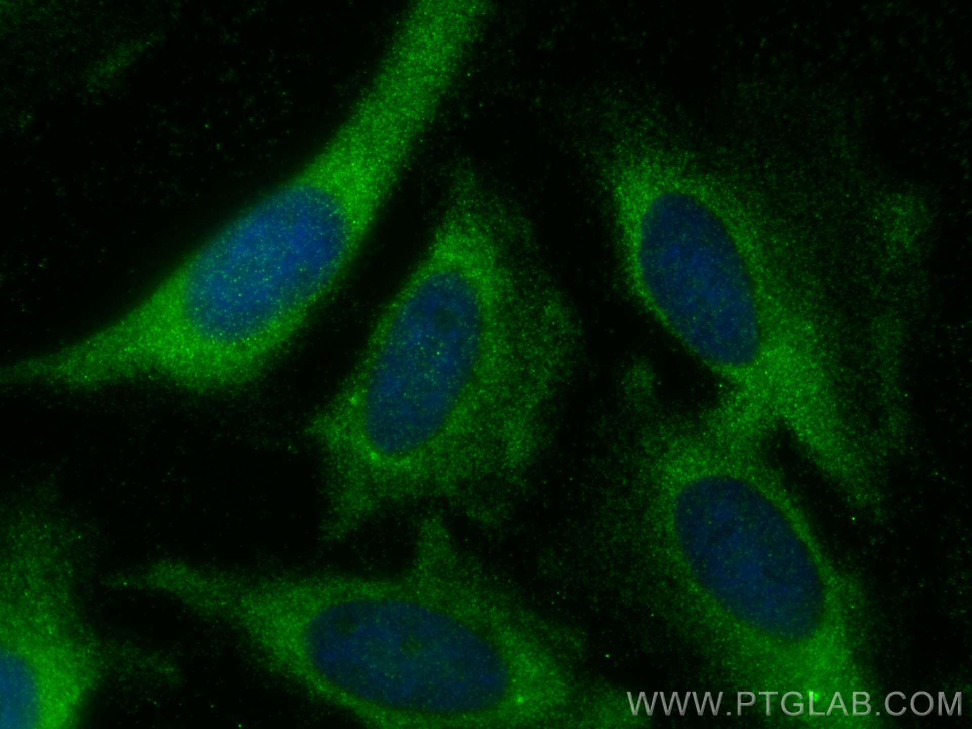 IF Staining of HeLa using 20382-1-AP