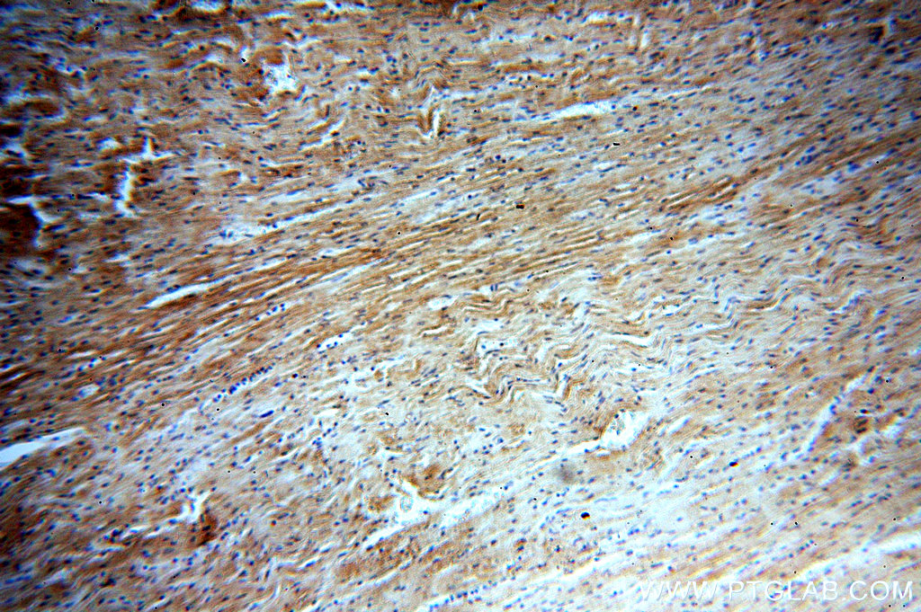 IHC staining of human heart using 20382-1-AP