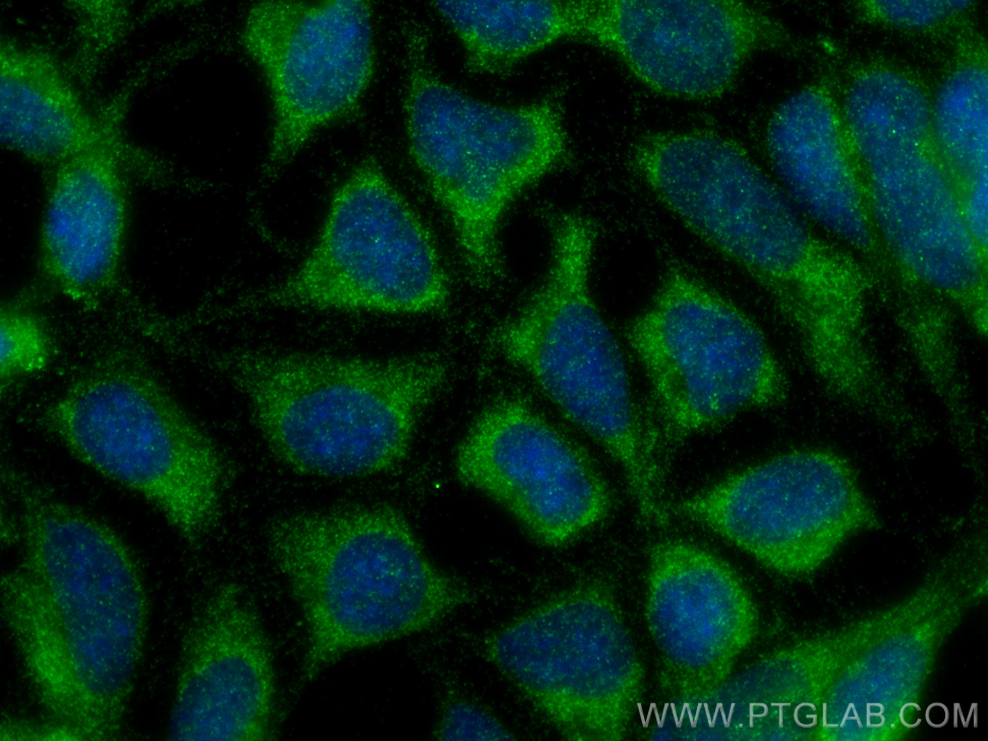 IF Staining of HEK-293 using 16924-1-AP