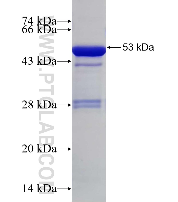 ATG4D fusion protein Ag31819 SDS-PAGE ATG4D fusion protein Ag31819 SDS-PAGE