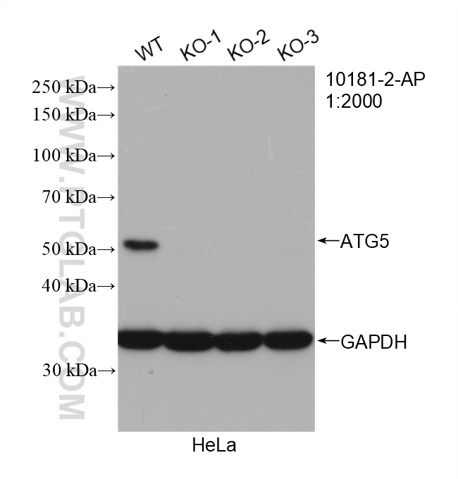 WB analysis of HeLa using 10181-2-AP