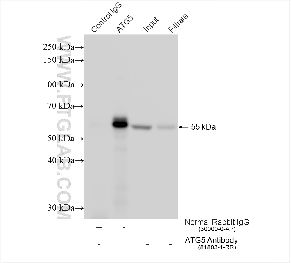 IP experiment of HeLa using 81803-1-RR (same clone as 81803-1-PBS)