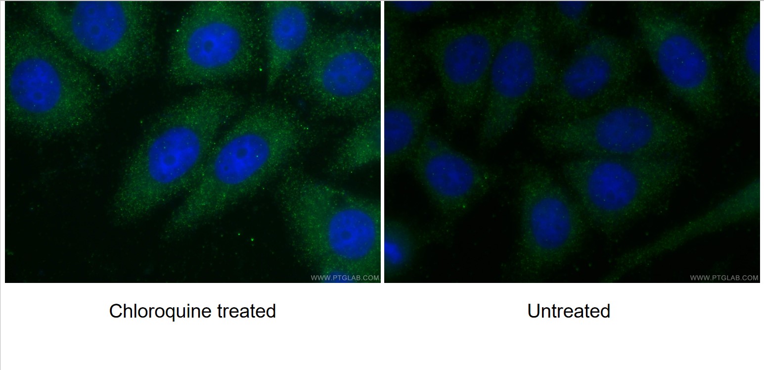 IF Staining of HepG2 using 10088-2-AP